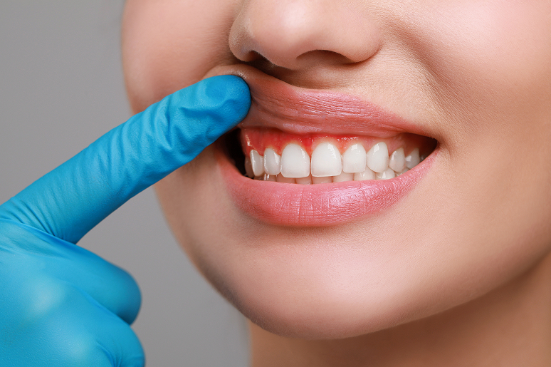 Digital dental imaging technology