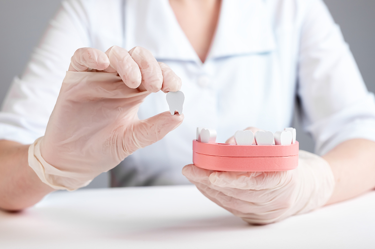 Implant bridge procedure